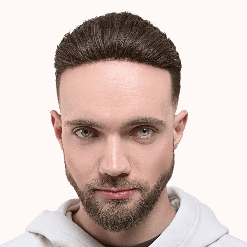 Turkish Hair Transplant