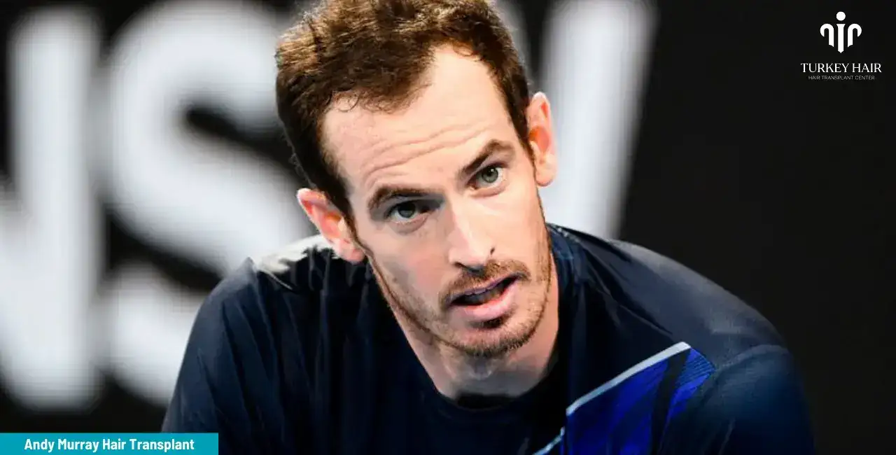 The Secret Details Of Andy Murray'S Hair Transplant Surgery