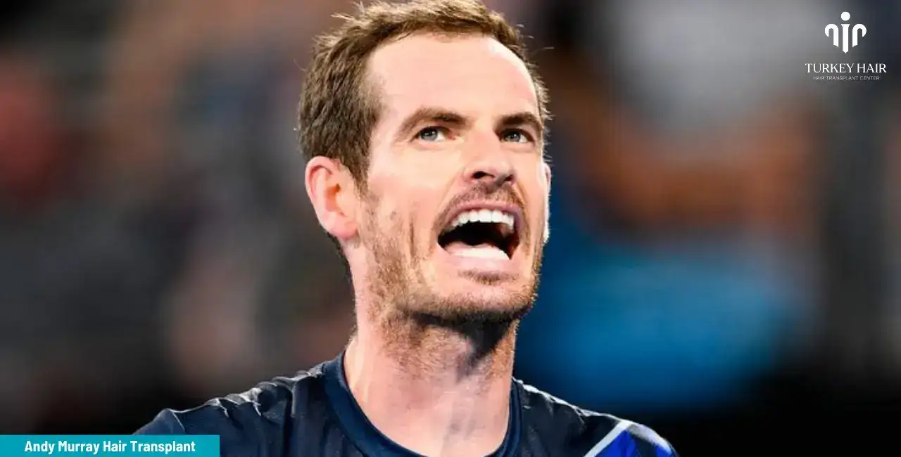 Andy Murray And His Hair Transplant