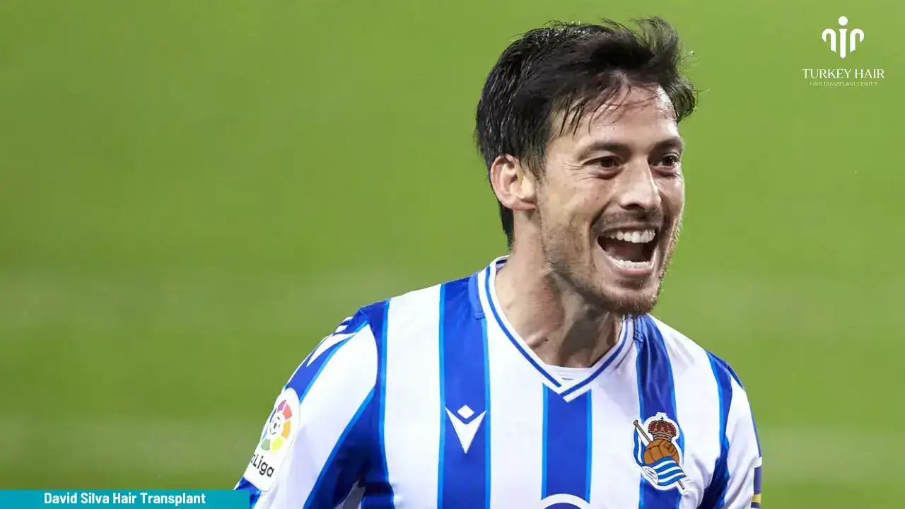 David-Silva-Hair-Transplant-1 David Silva Hair Transplant In Turkey