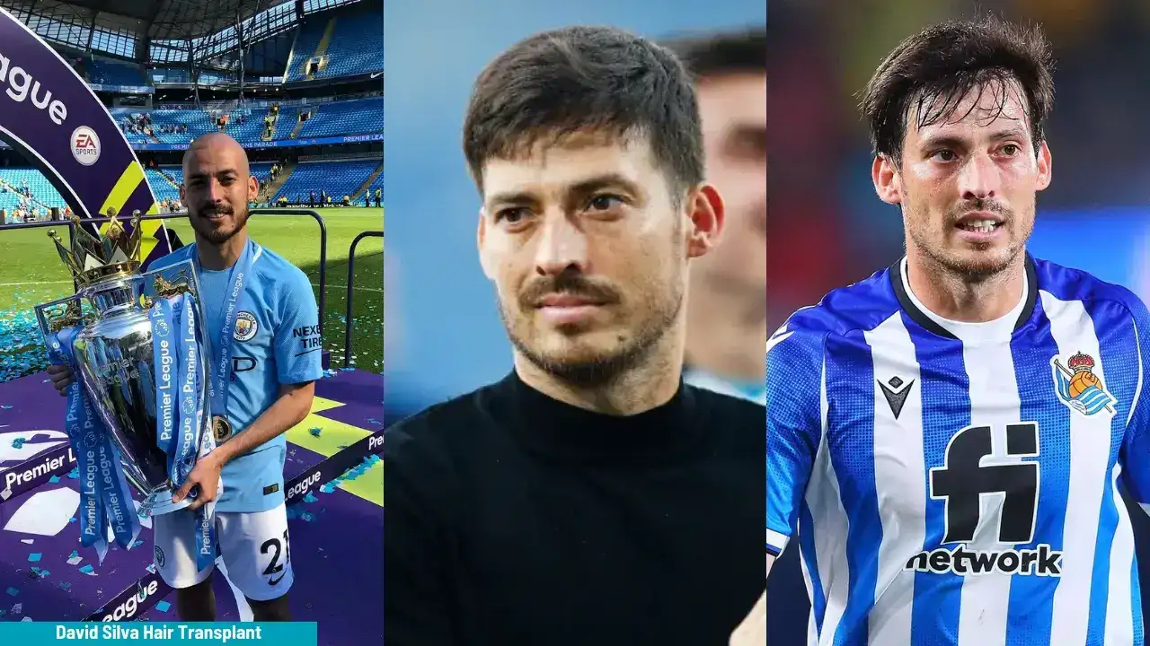 Discover David Silva Hair Transplant 2026 2 David Silva Hair Transplant