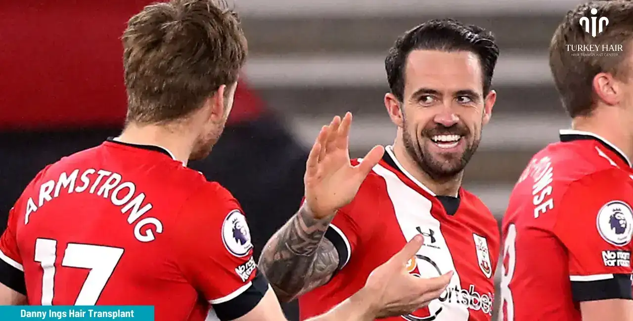The Effect Of Danny Ings Hair Transplant On His Confidence And Professional Life