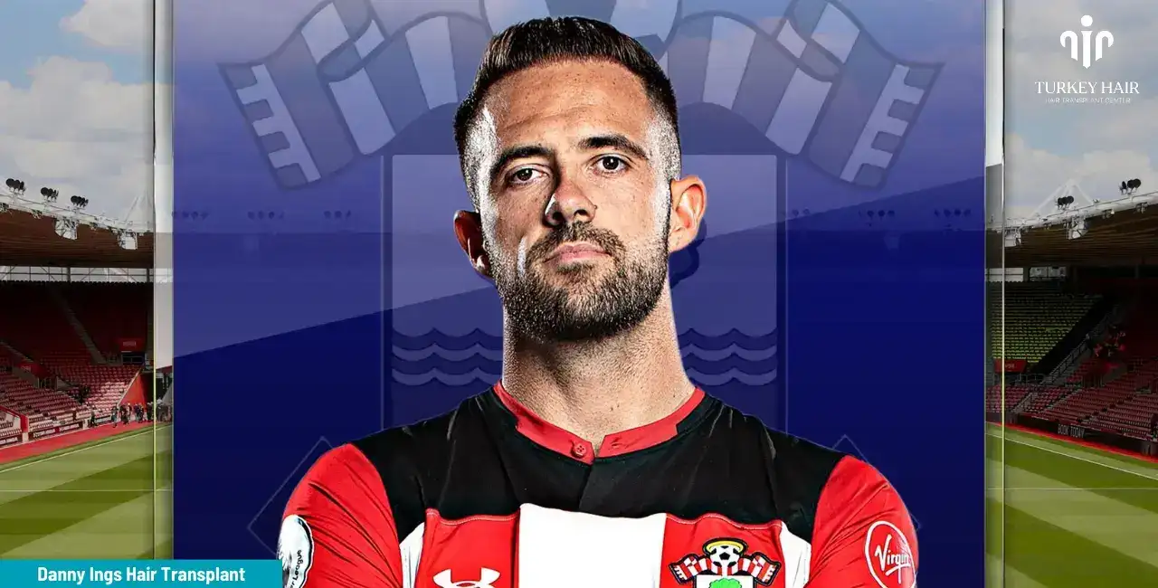 From Turkey Hair Center On Danny Ings' Hair Transplant