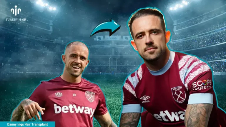 Danny Ings' Hair Transplant