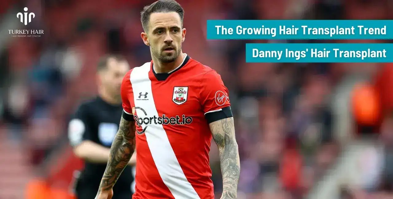 Danny Ings Hair Transplant