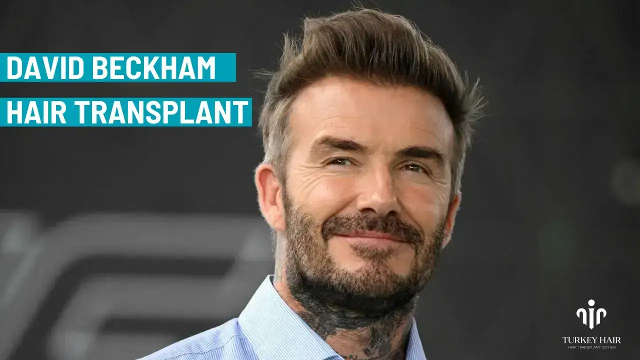 David Beckham Hair Transplant (4) (1) David Beckham Hair Transplant