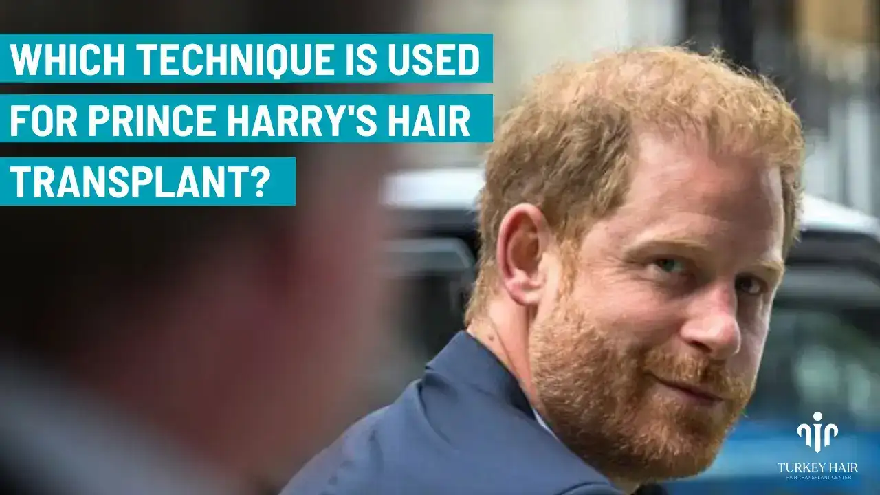 Prince Harry Hair Transplant (2) (1) Prince Harry Hair Transplant