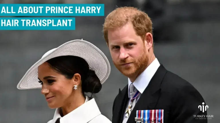 Prince Harry Hair Transplant