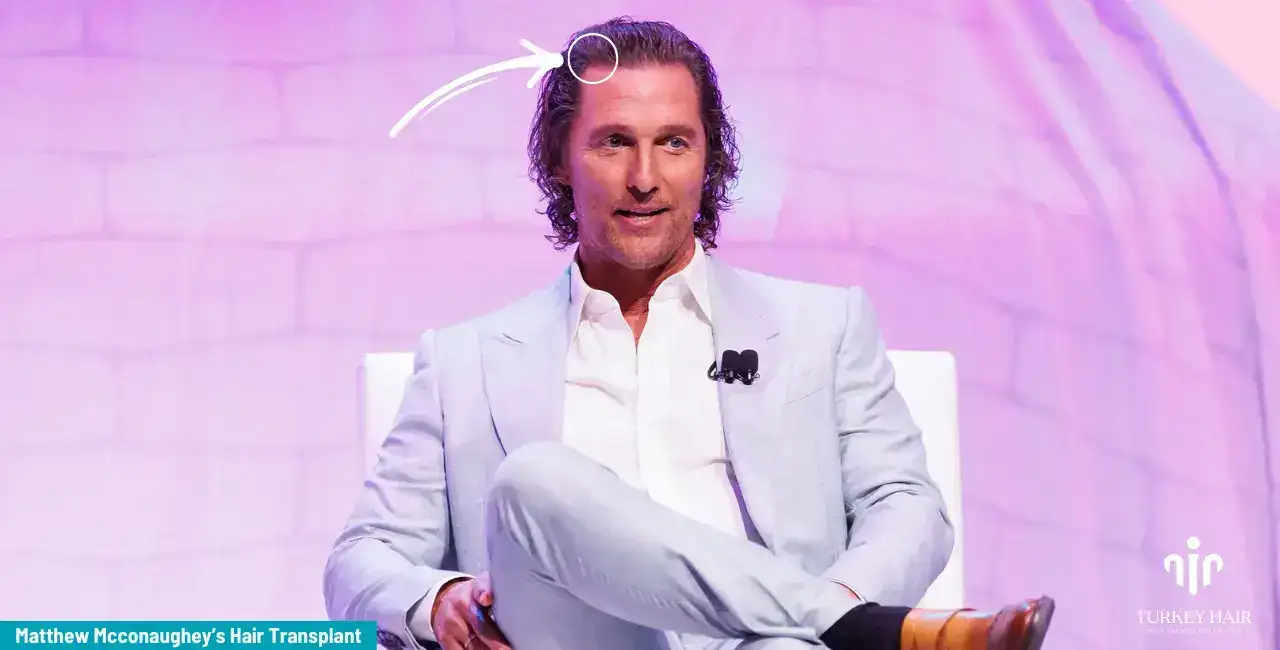 Matthew Mcconaughey Hair Transplant