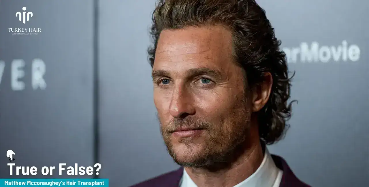 Matthew Mcconaughey Hair Transplant