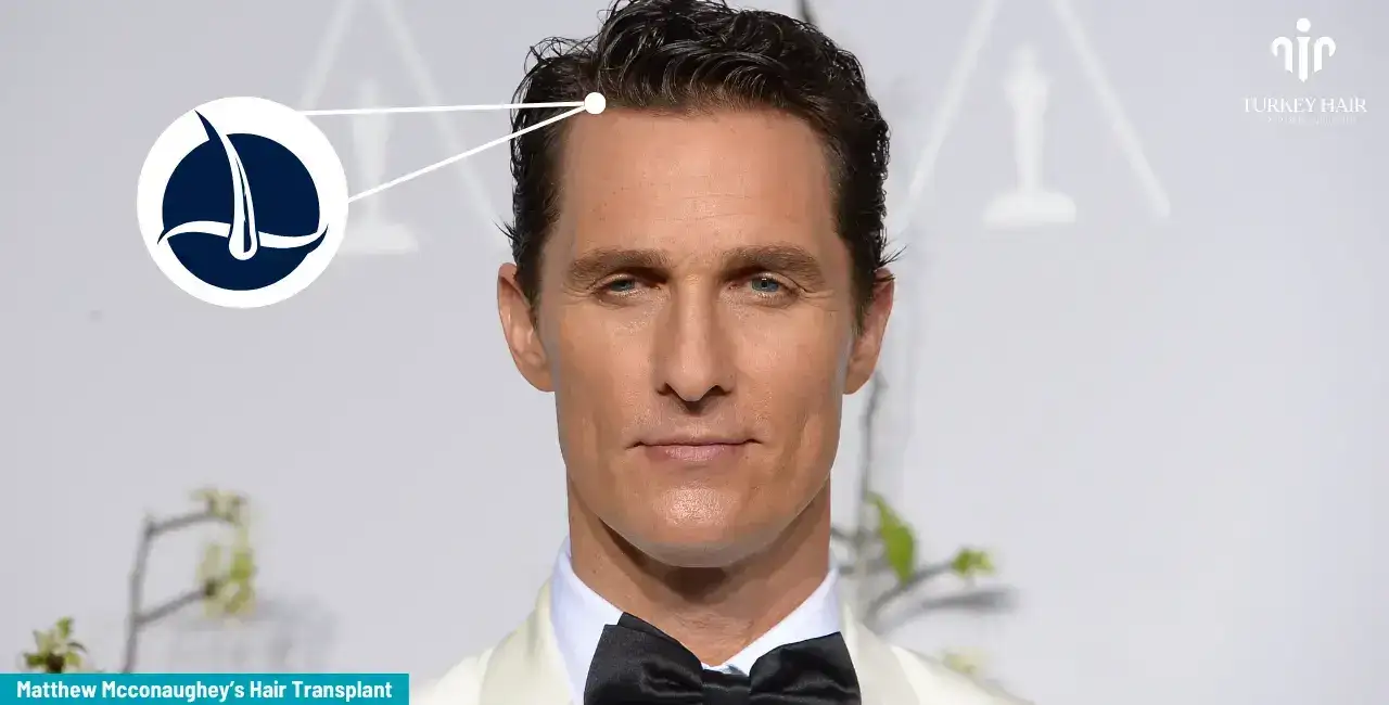 Matthew Mcconaughey