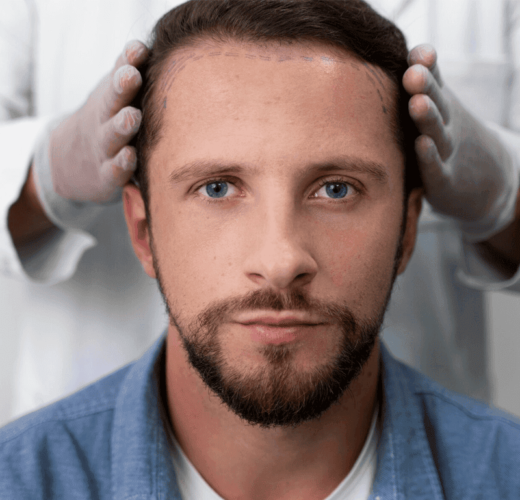 Hair Transplant