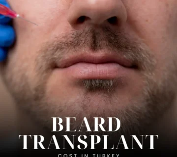 Beard Transplant In Turkey
