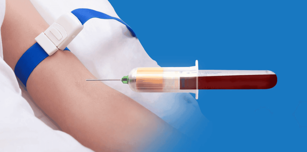 Prp Hair Treatment 2 Prp Treatments