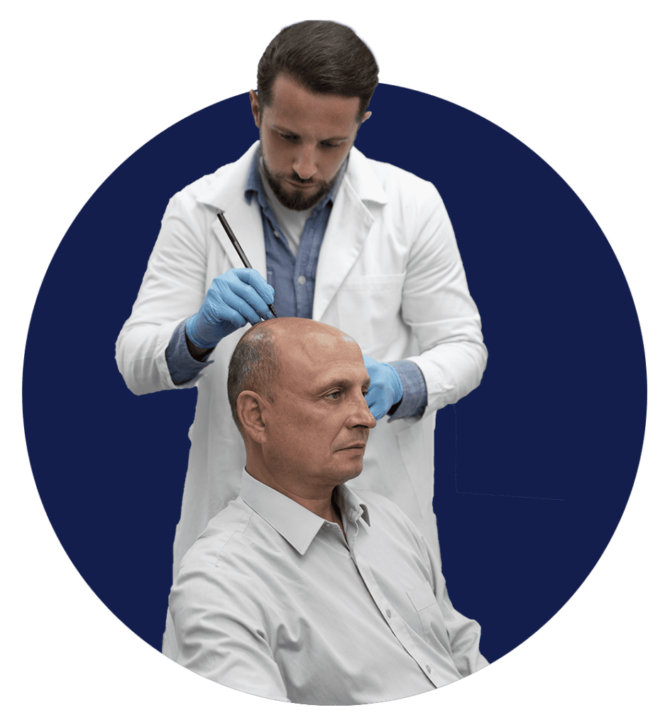 Turkish Hair Transplant