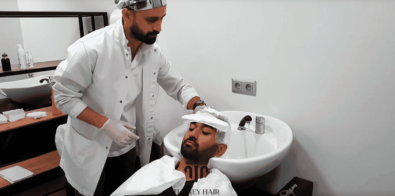 Washing After Hair Transplant