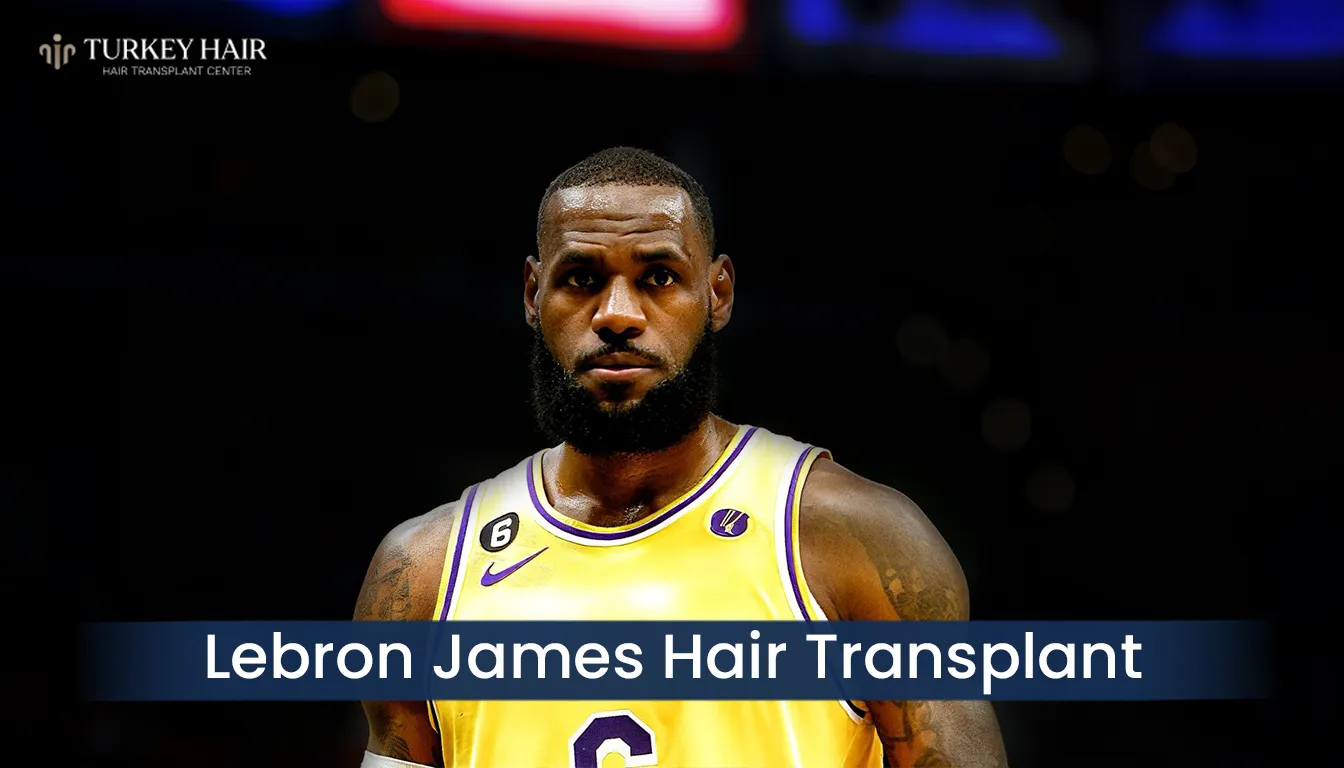 Lebron James Hair Transplant Before And After Transformation Cover Image