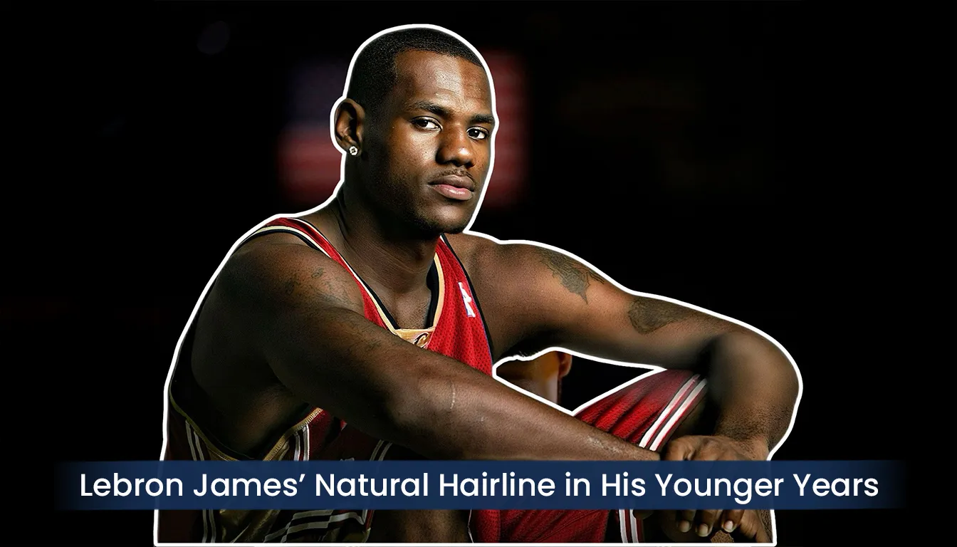 Lebron James Natural Hairline During Early Nba Career Before Hair Loss