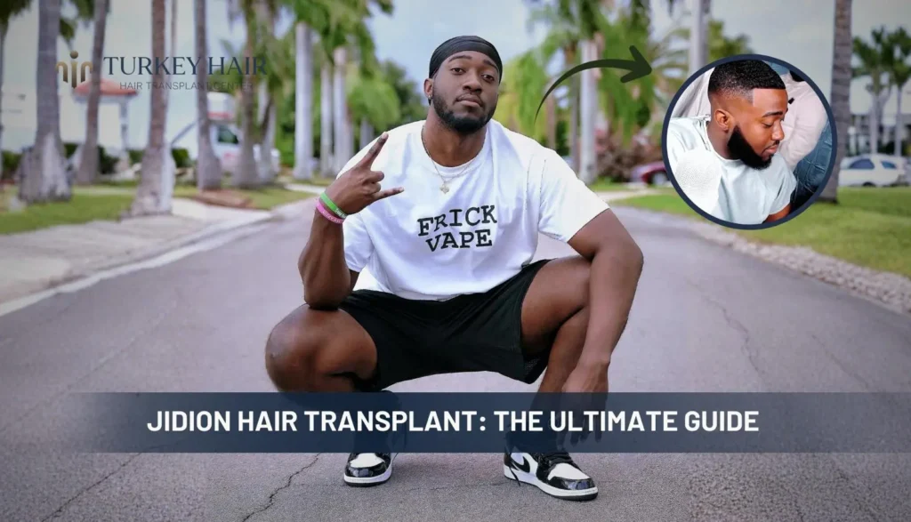 Jidion Hair Transplant