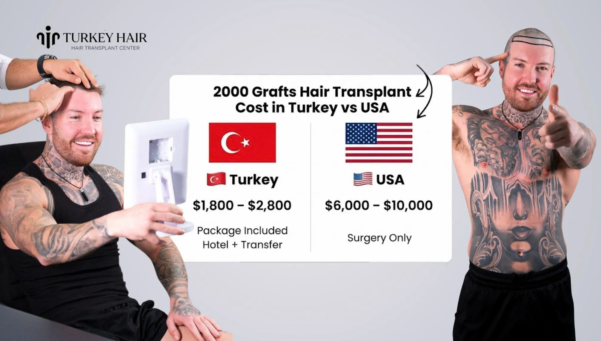 2000 Grafts Hair Transplant Cost In Turkey For Usa Patients