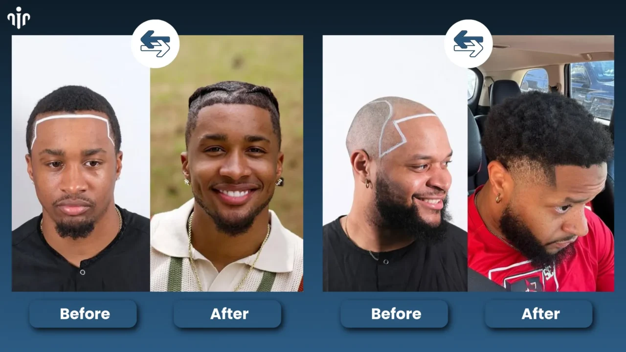 Before And After Hairstyle Comparisons