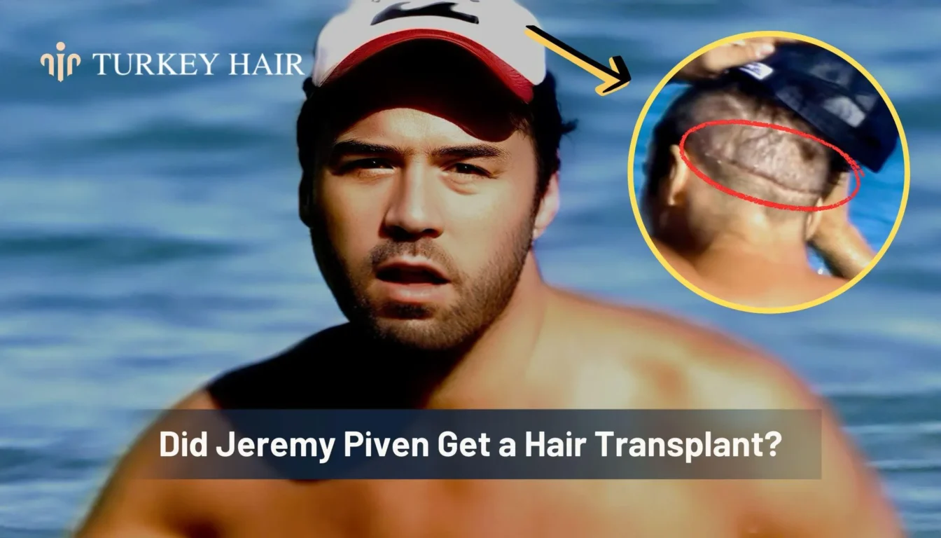 Did Jeremy Piven Get A Hair Transplant Did Jeremy Piven Get A Hair Transplant