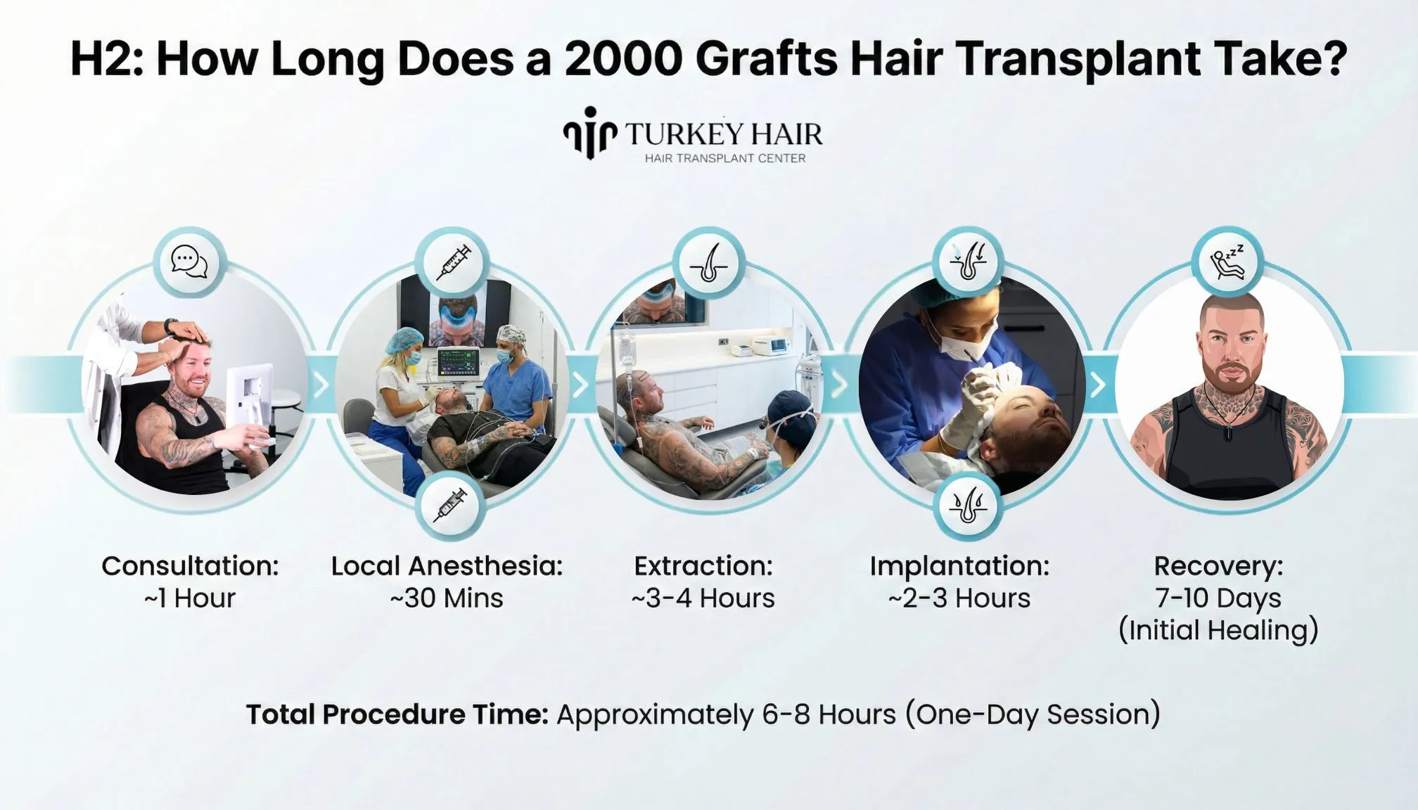 How Long Does A 2000 Graft Hair Transplant Take