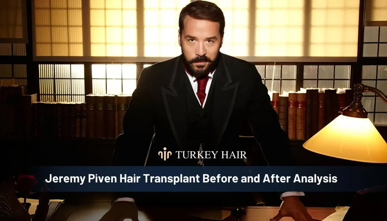 Jeremy Piven Hair Transplant Before And After Analysis Jeremy Piven Hair Transplant Before And After Analysis