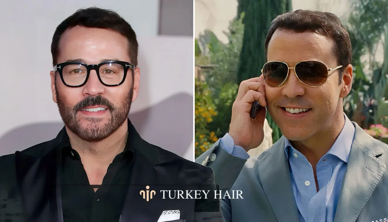 Natural Look, Hair Direction, And Symmetry Natural Look, Hair Direction, And Symmetry