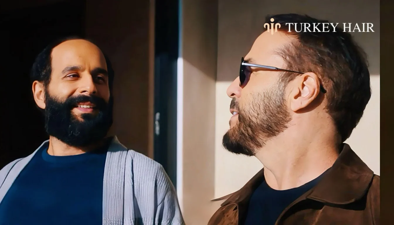 Was Jeremy Piven’s Hair Transplant Successful Was Jeremy Piven’s Hair Transplant Successful