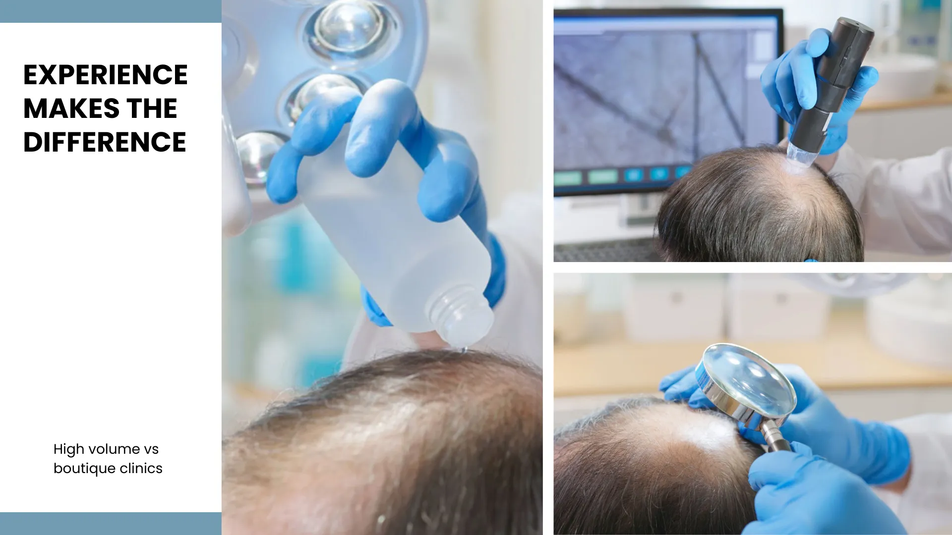 Hair Transplant Kuwait Vs Turkey - Cost, Quality And Facts 4 Clinic &Amp; Specialist'S Expertise The Value Of Experience