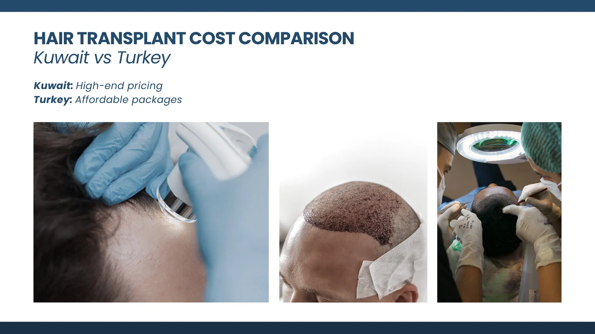 Hair Transplant Kuwait Vs Turkey - Cost, Quality And Facts 6 Hair Transplant Costs In Turkey