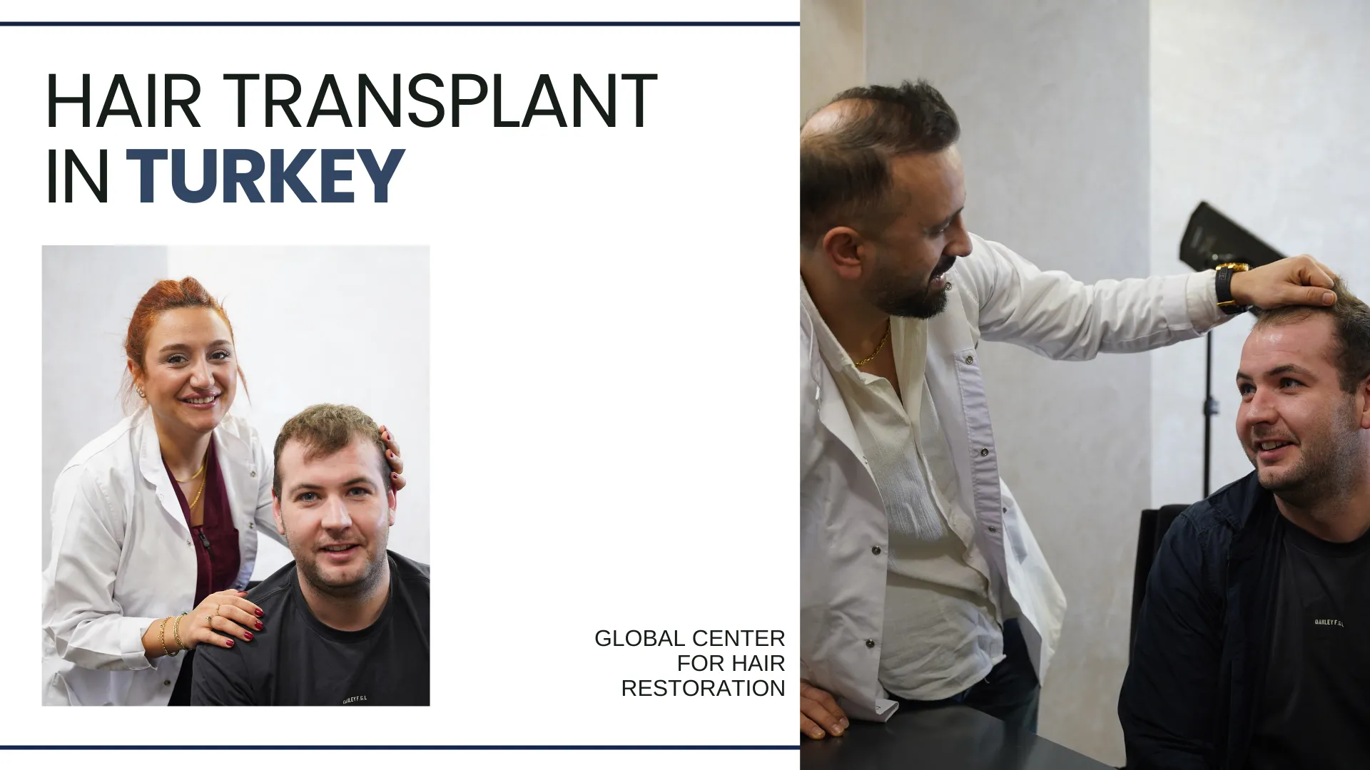 Hair Transplant Kuwait Vs Turkey - Cost, Quality And Facts 7 Hair Transplant In Kuwait