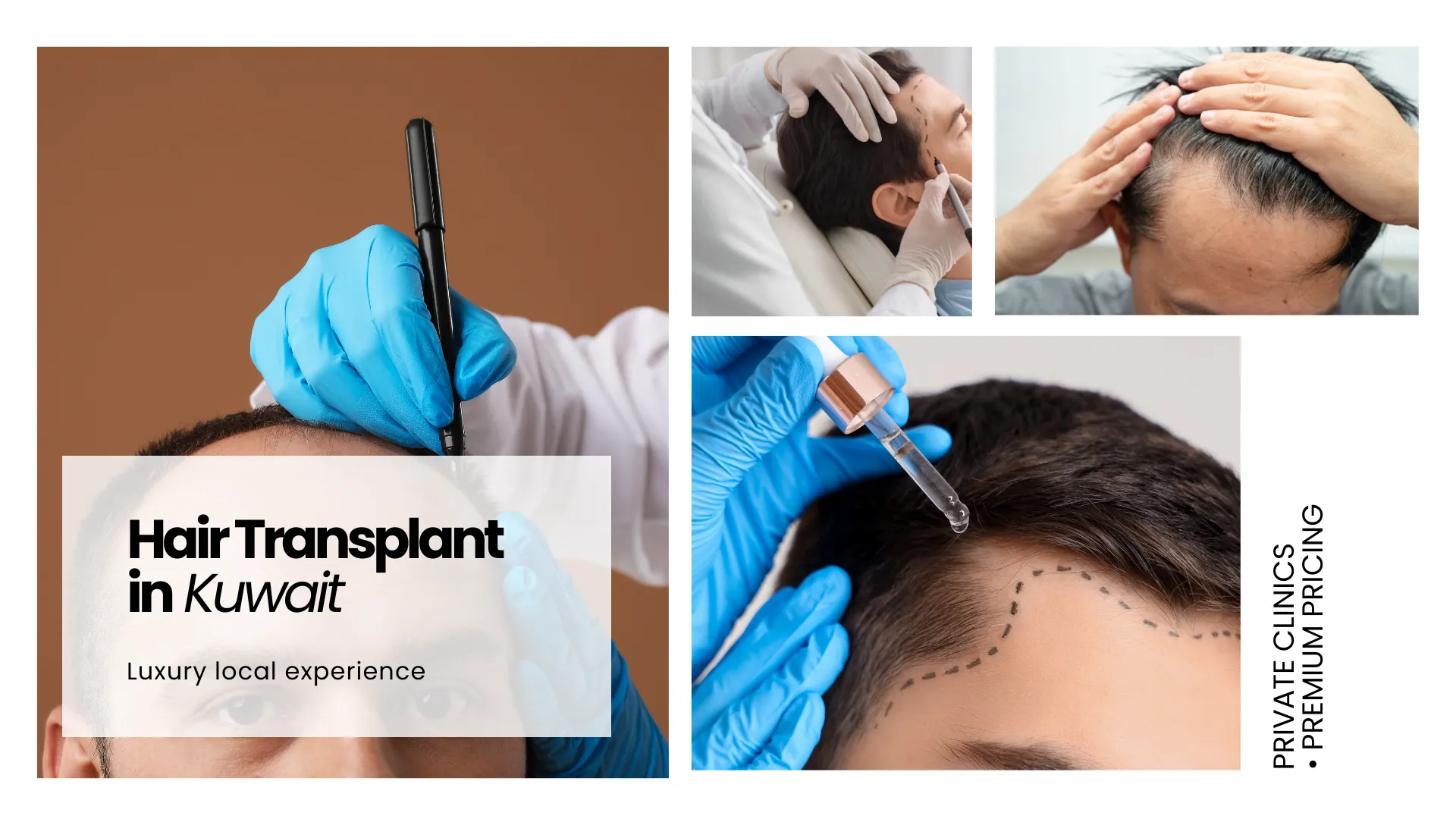 Hair Transplant Kuwait Vs Turkey - Cost, Quality And Facts 5 Hair Transplant In Kuwait