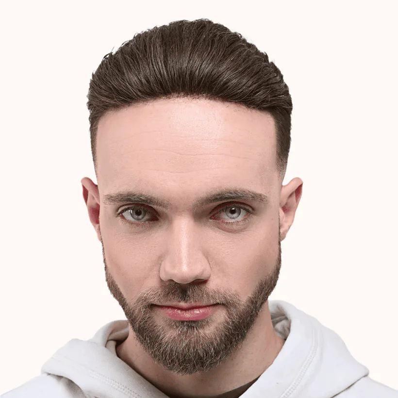 Turkish Hair Transplant