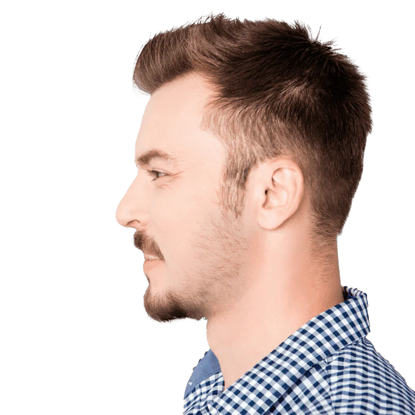 Turkey Hair Transplant Center