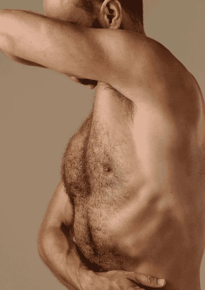 Body-Hair-Transplant-01 Body Hair Transplant