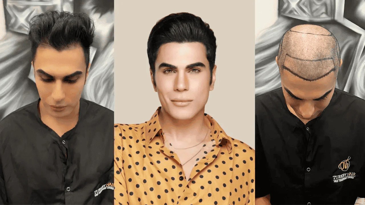Turkey Cosmetic And Hair Transplant Center
