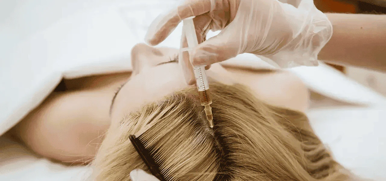 Scar Hair Transplant
