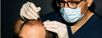 No Shave Hair Transplant 1