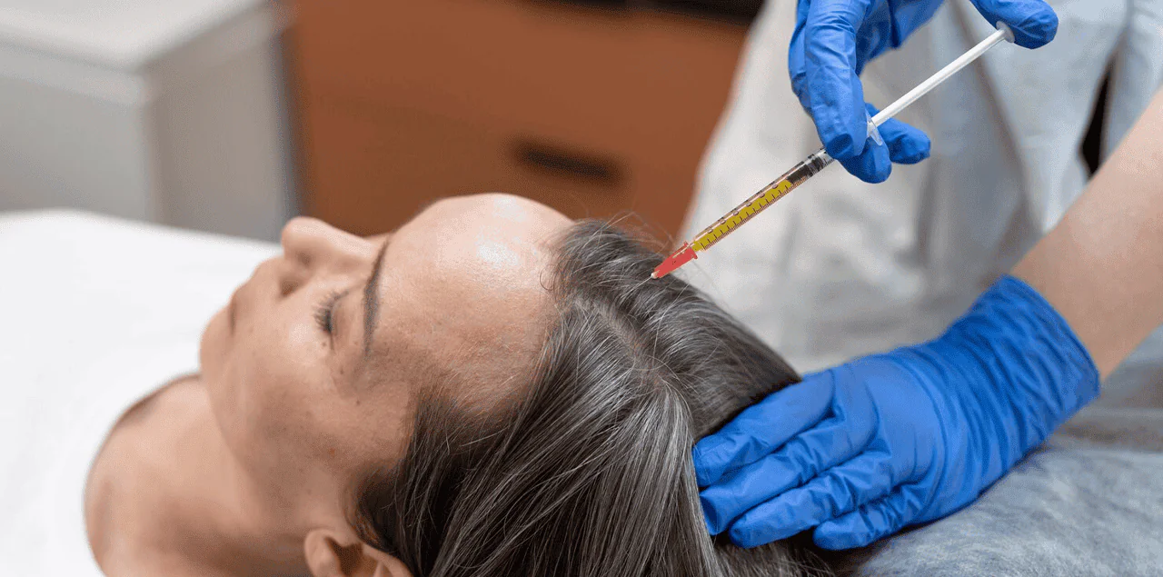 Female Prp Treatments