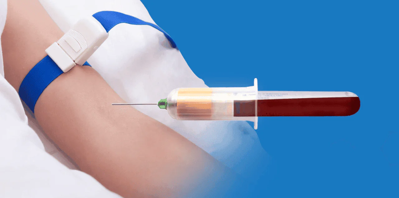 Prp Treatments