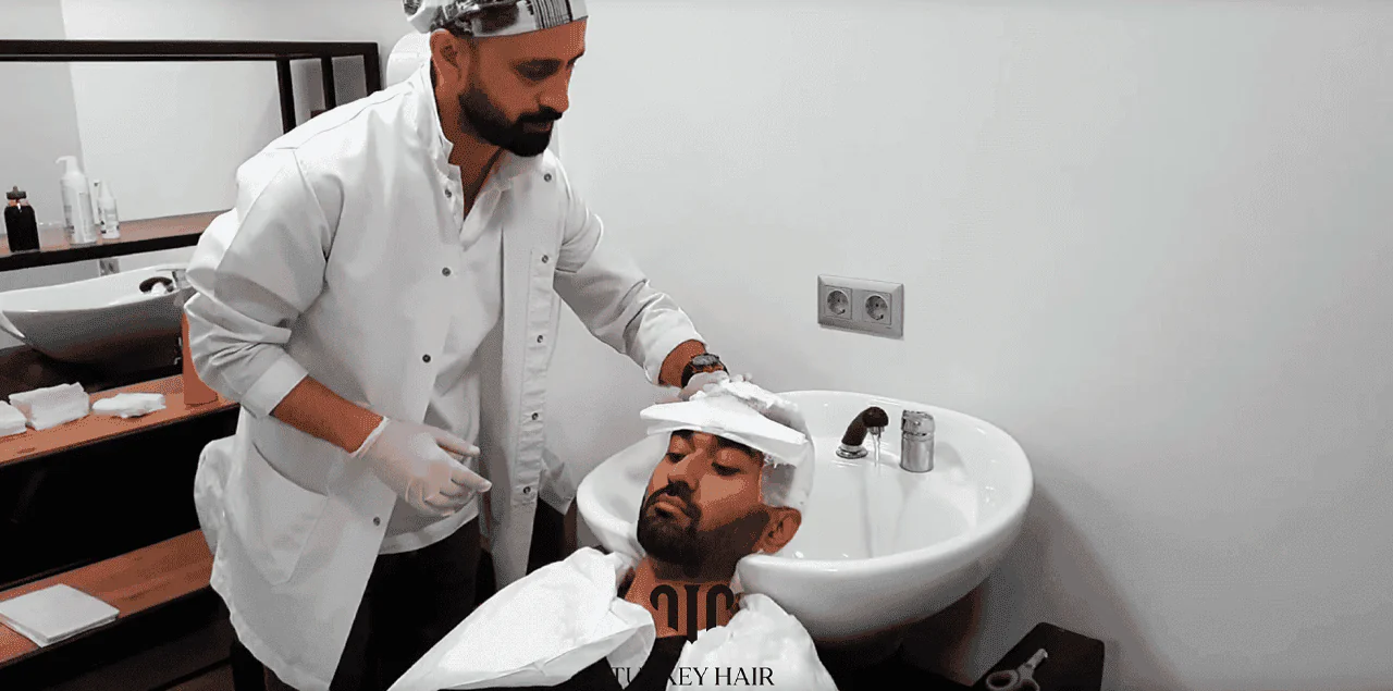 Washing After Hair Transplant
