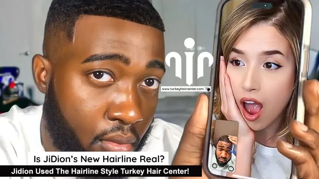 Jidion Hair Transplant